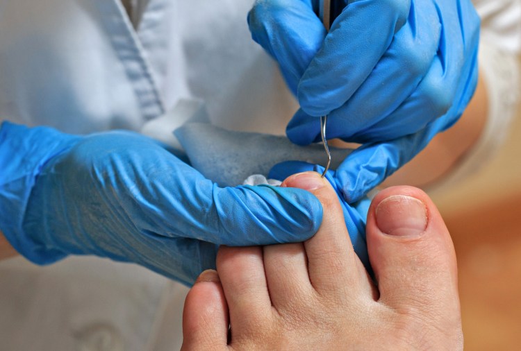 Foot health treatment